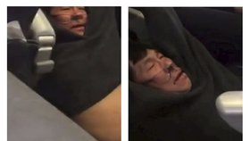 Na palubě United Airlines zbili lékaře Davida Daa.