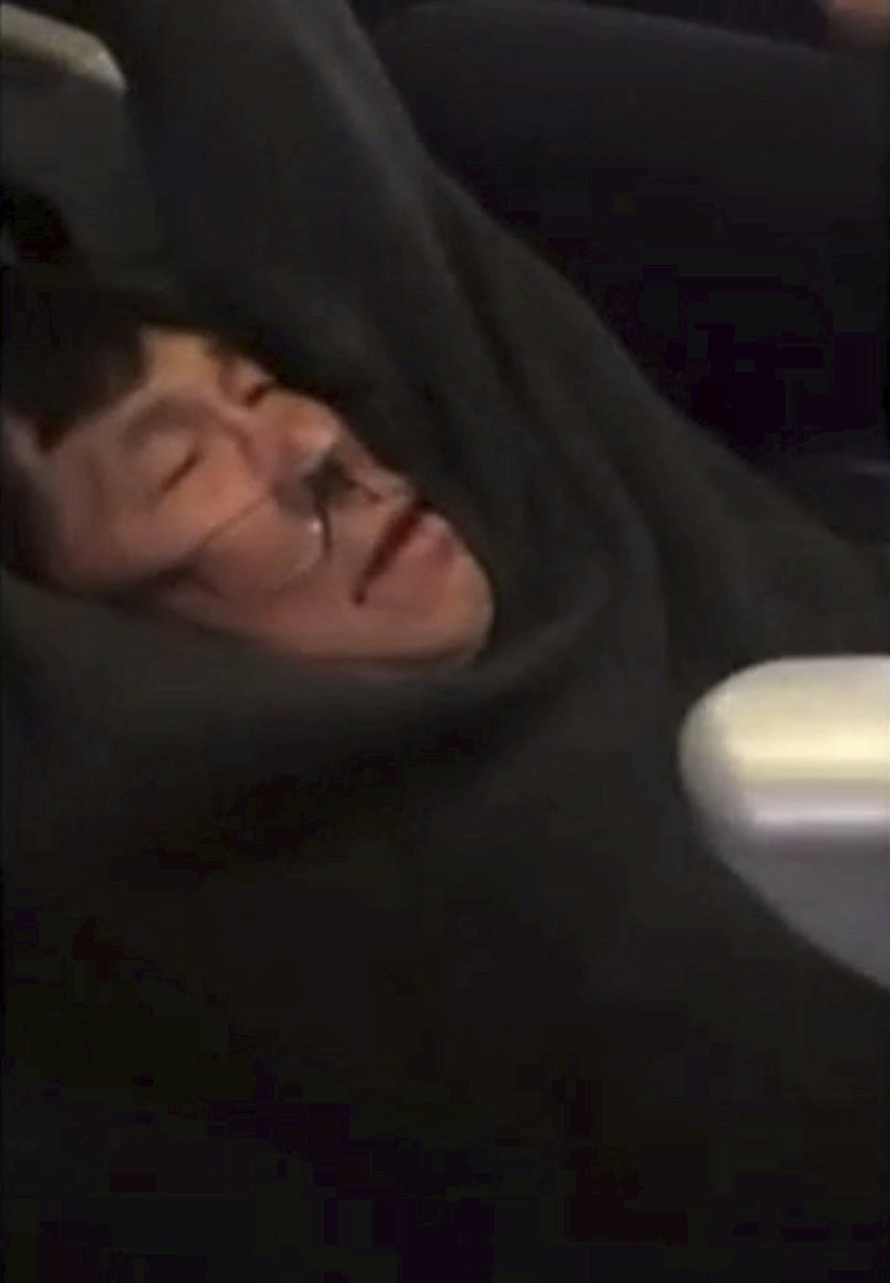 Na palubě United Airlines zbili lékaře Davida Daa.