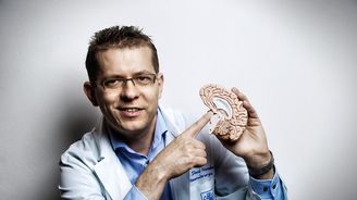 Neurochirurg David Netuka: Ženský a mužský mozek nerozeznám, mozek pijana ano