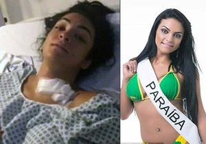 Brazilská kráska se pokusila o sebevraždu. Přežila, ale je ochrnutá od pasu dolů.