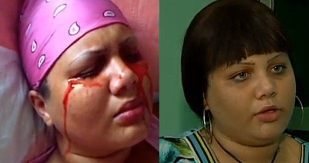 Dívka z Dominikánské republiky pláče a potí krev