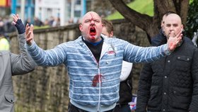 Sobotní demonstrace v anglickém Doveru se proměnila v krvavá jatka poté, co se tam střetly dvě protichůdné skupiny.