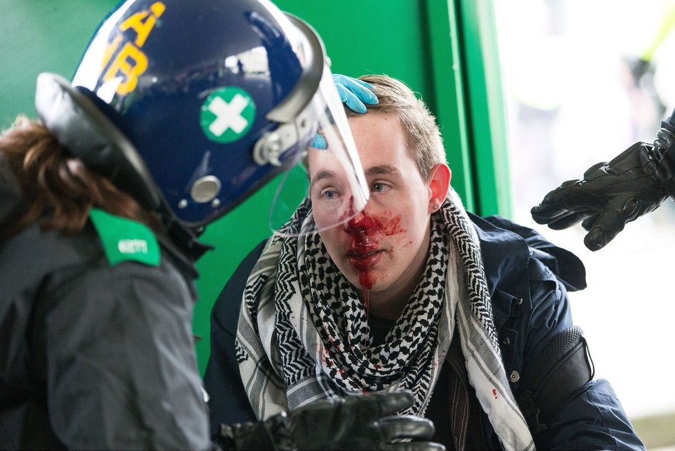 Sobotní demonstrace v anglickém Doveru se proměnila v krvavá jatka poté, co se tam střetly dvě protichůdné skupiny.