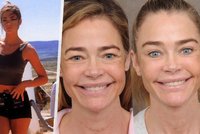 Bond girl Denise Richardsová: Plastika za sedm milionů!