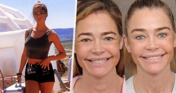 Bond girl Denise Richardsová: Plastika za sedm milionů!