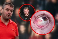 Vhozená pyrotechnika zranila otcem se synem! Policie hledá útočníka z derby pražských S