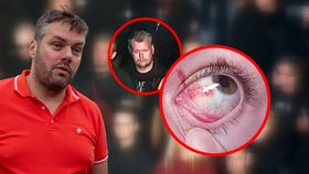 Vhozená pyrotechnika zranila otce se synem! Policie našla útočníka z derby pražských S