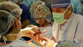 Unikátní porod šesterčat v Alabamě trval pouhé tři minuty