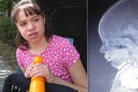 Vanda (11) má těžce poškozený mozek: Kdo nezažil tolik bolesti, neví, vzkazuje maminka
