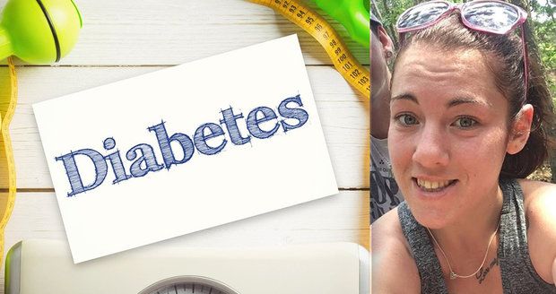 Míša (23) trpí cukrovkou: Nemám se zač stydět, cítím se jako superhrdinka