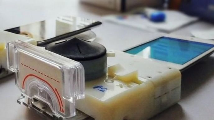 diagnostická laboratoř krve k mobilu z dílny Sia Labs