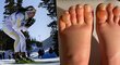 Strašlivé zranění slavné laufařky: Mráz jí zničil nohy! Skončila v nemocnici