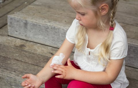 Na ochraně dětí před sluncem nešetřete, radí dermatoložka