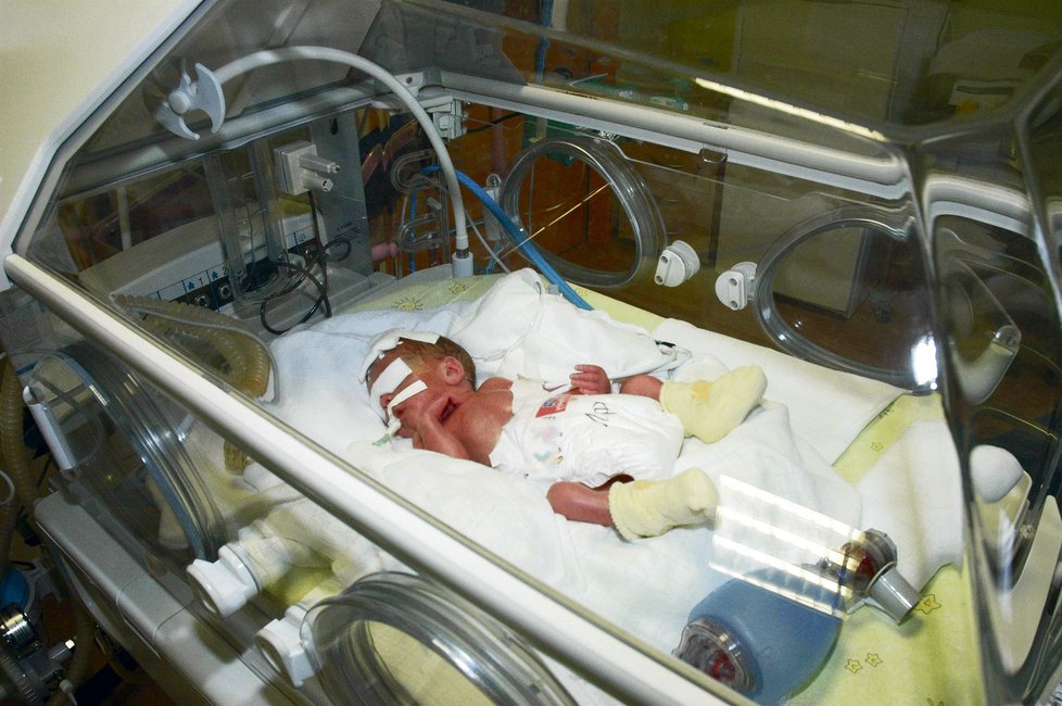 Jedno z miminek na neonatologickém oddělení v Plzni.