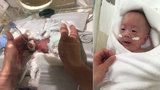 Nejmenší chlapec na světě vážil 268 gramů: V nemocnici bojoval o život pět měsíců