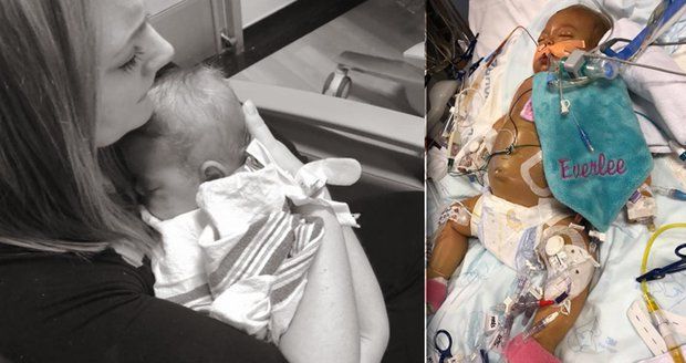 Nemocná holčička (†8 měs.) se transplantace nedočkala: Dojemnou fotkou chce matka změnit svět