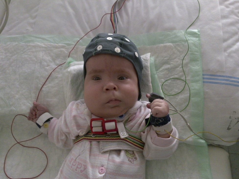 Vyšetření EEG