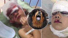 Lucinku (9) potrhal v obličeji pes: Ústavní soud věc smetl ze stolu, majitelé nedostanou ani pokutu