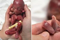 Porodila v 19. týdnu a ukázala fotky mrtvého plodu. Hnus, nebo osvěta?