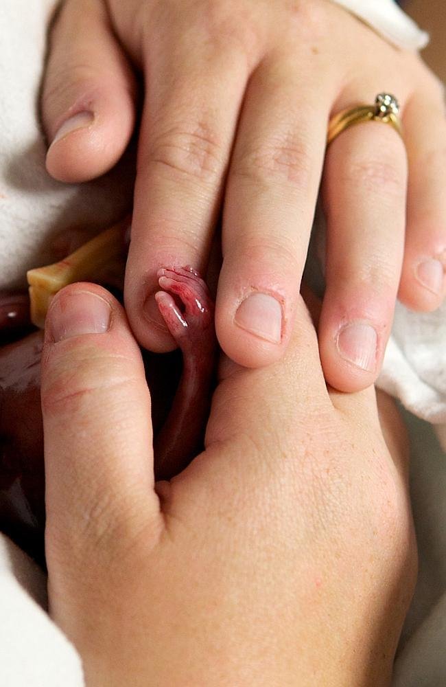 V jiných zemích jsou potraty dovoleny i v 19. týdnu těhotenství. Fotografka Alexis se rozhodla ukázat, jak miminko tou dobou vypadá. Sama totiž předčasně porodila, dítě zemřelo.