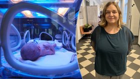 Anna (35) porodila předčasně, dcera váží 710 gramů: Lékaři zvládají zachránit i menší miminka