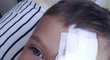 Tříletý Olek trpí rakovinou oka a potřebuje operaci v Americe