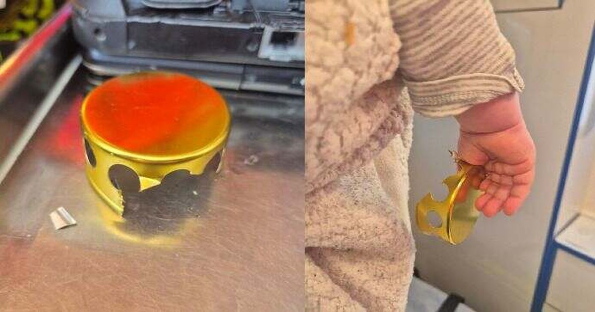 Horny Marsov: el dedo de un bebé atrapado en la tapa de una vela