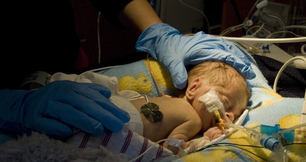Další porod doma skončil smrtí dítěte. Kdyby matka rodila v nemocnici, dítě žije, tvrdí lékaři - ilustrační foto