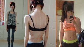 Dívka vážila 28 kg: Porazila anorexii a je známou pekařkou