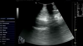Podle ultrazvuku Haley není těhotná.