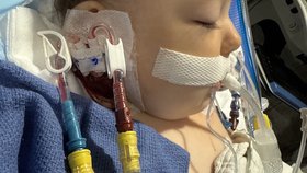 Dívka s vážnou infekcí skončila na ventilaci.