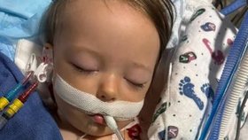 Dívka s vážnou infekcí skončila na ventilaci.