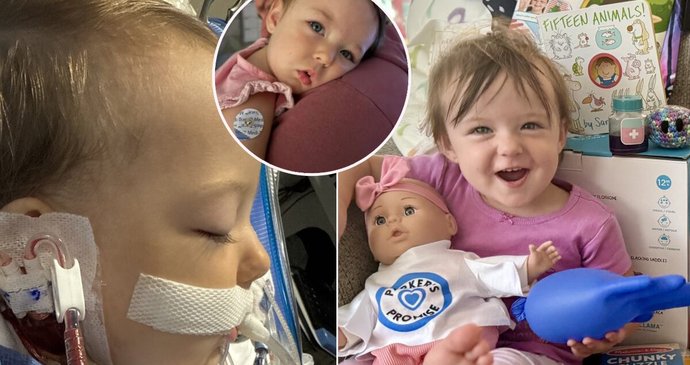 Dívka s vážnou infekcí skončila na ventilaci.