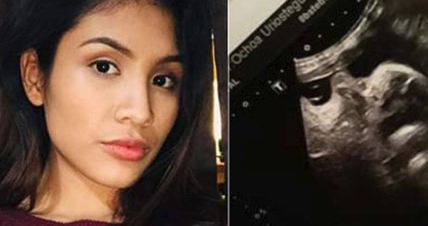 Žena zabila těhotnou dívku a vyřízla jí dítě z břicha: Lidem tvrdila, že miminko je její!
