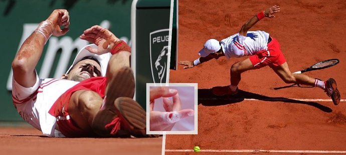 Novak Djokovič si po ošklivém karambolu u sítě způsobil krvavé zranění na pravém ukazováčku