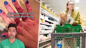 Maminka se v obchodě nakazila nemocí? Doktor varuje před fekálními bakteriemi v nákupních košících!