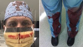 Doktoři sdílejí na Twitteru zakrvácené fotografie, jaké je to starat se o oběti střelných zbraní