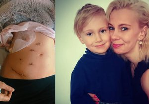 Lucie bojuje s onkologickým onemocněním, prožila i domácí násilí.