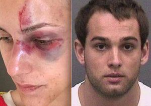 Z hvězdičky motokrosu se vyklubal pořádný násilník. Jeho přítelkyně zveřejnila fotky plné podlitin a řezných ran.
