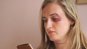 Obětem domácího násilí pomáhá aplikace Bright Sky (ilustrační foto)