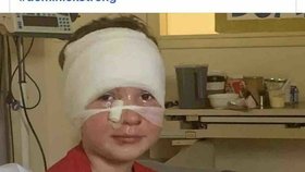 Šestiletý Dominick Krankall utrpěl vážné popáleniny poté, co po něm osmiletý chlapec od sousedů hodil zapálený tenisový míček.