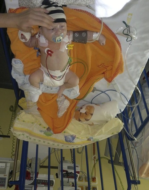 Pár týdnů po narození musel Dominik do nemocnice, kde byl připojen na přístroje.