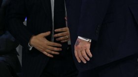 Prezident USA Donald Trump překvapil v Davosu obří modřinou (22.1.2026).