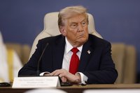 Trump na vyšetření po modřinách a otoku nohou: Velká zpráva o jeho zdraví