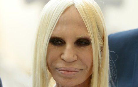 2017 - Donatella Versace to přehnala s plastikami.