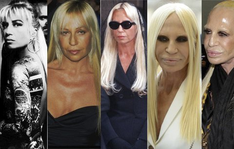 Donatella Versace neumí stárnout! Předávkování botoxem z ní udělalo UFO