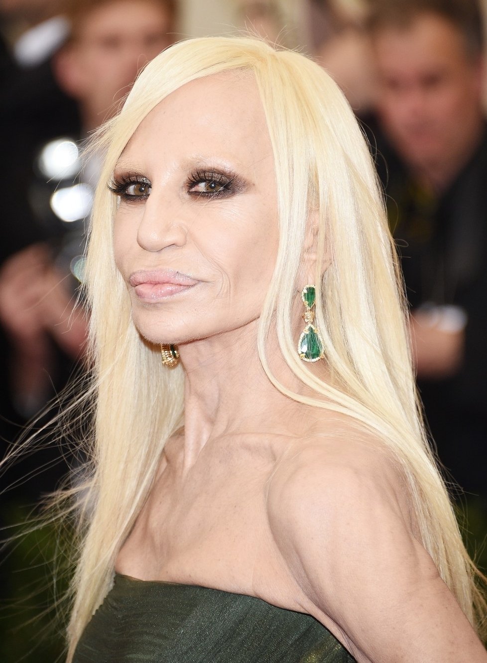Donatella Versace to přehnala s botoxem.