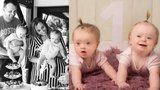 Dvojčata Zuzanka a Maruška se narodila s Downovým syndromem: Děje se to jednou za 200 let!