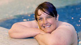 Britka se 30 let nesprchovala: Strachu z vody ji zbavila až hypnóza