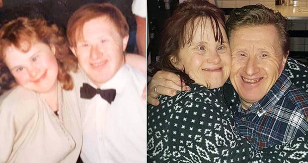 Tragický konec prvního manželského páru s Downovým syndromem: Tommy podlehl koronaviru
